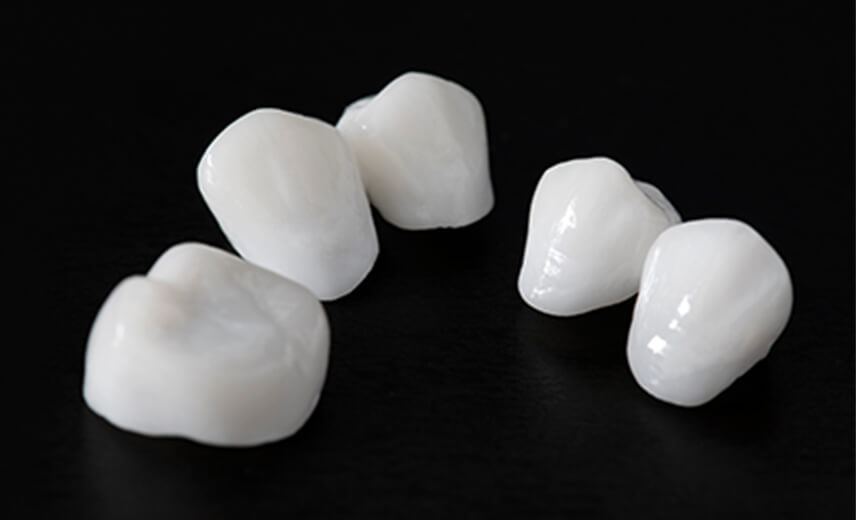 レミントン歯科審美歯科ジルコニア