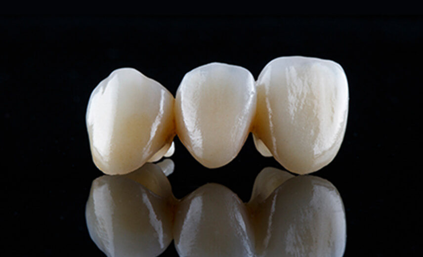 レミントン歯科審美歯科ジルコボンド